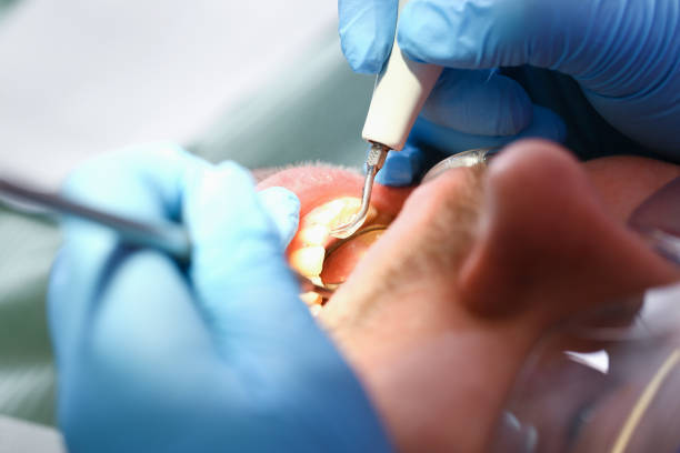 Best Holiday Emergency Dentist in Huntsville, TN