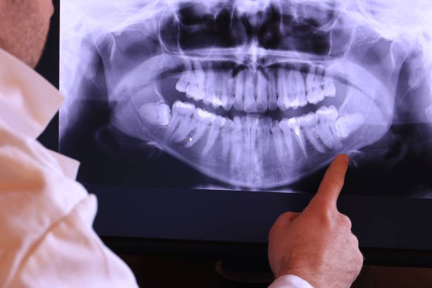 Best Emergency Dentist for Knocked-Out Tooth in Huntsville, TN
