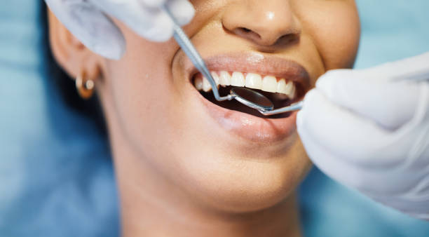 Best Emergency Dental Services for Seniors in Huntsville, TN