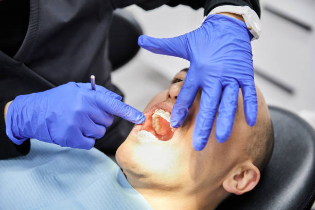 Best Emergency Dental Extractions in Huntsville, TN
