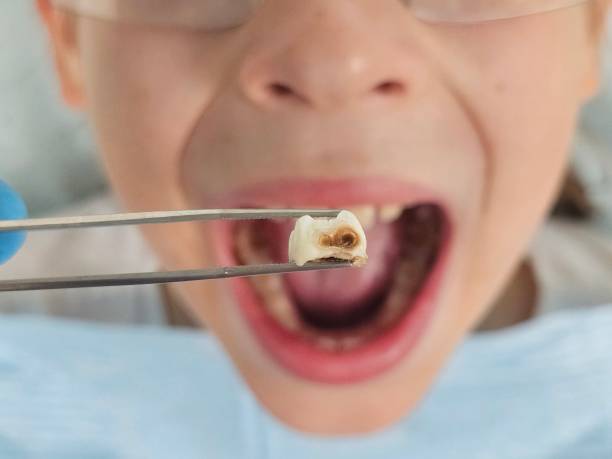 Best Orthodontic Emergency Dentist in Huntsville, TN
